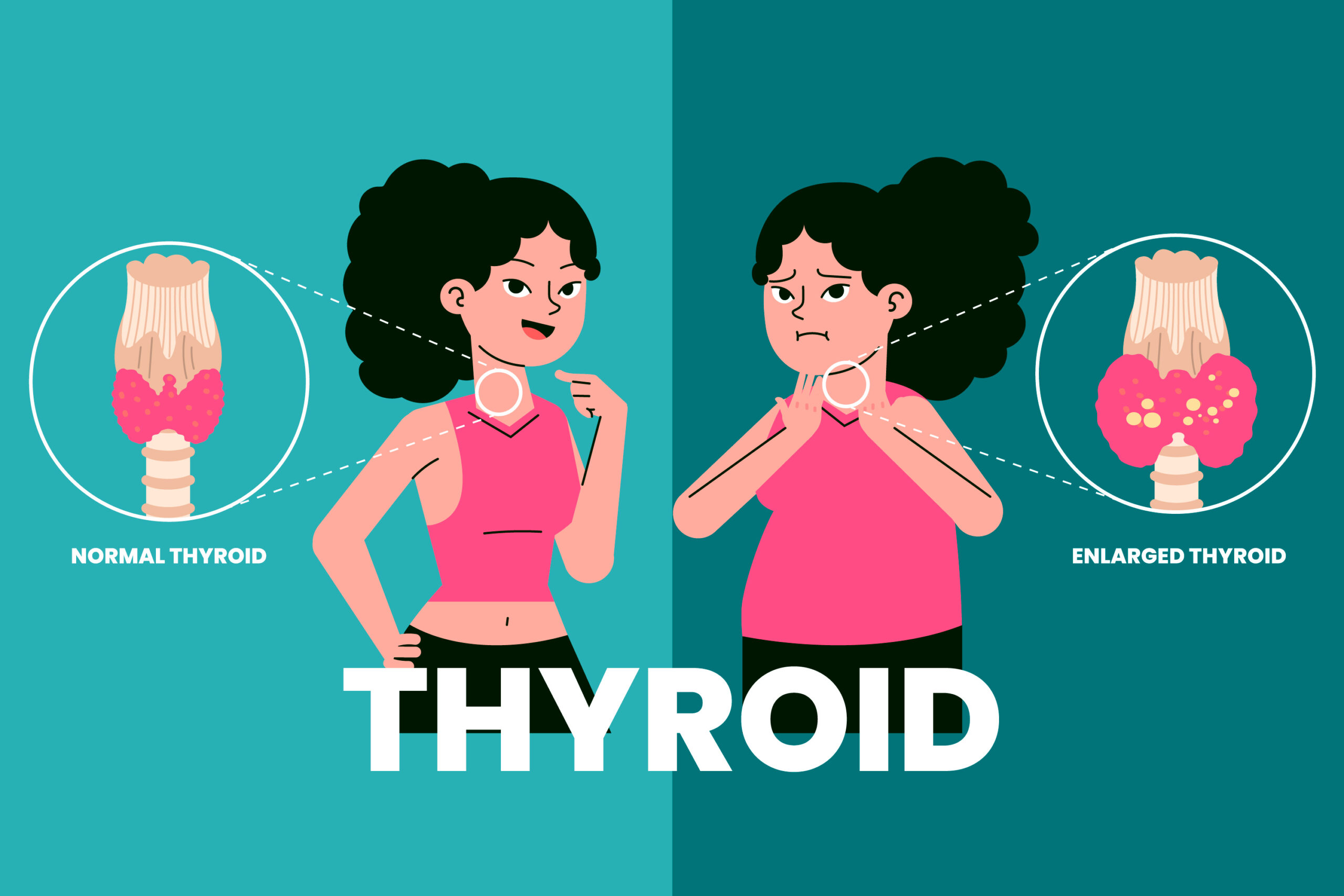The Silent Disease: Living With Hypothyroidism and What I Have Learned